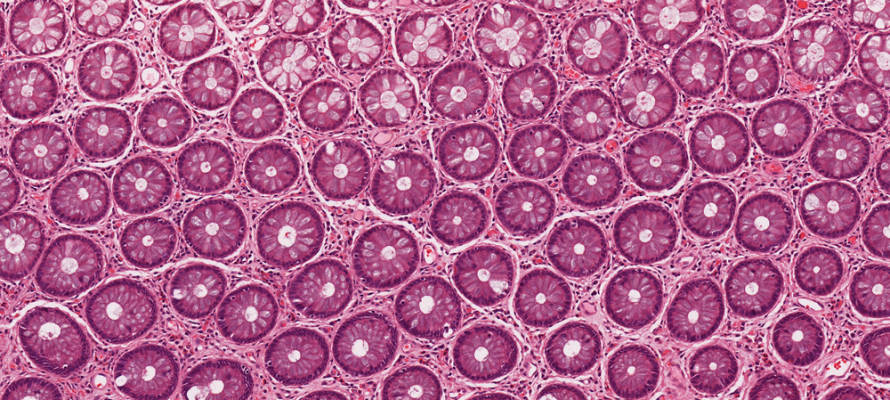 Tissue cells